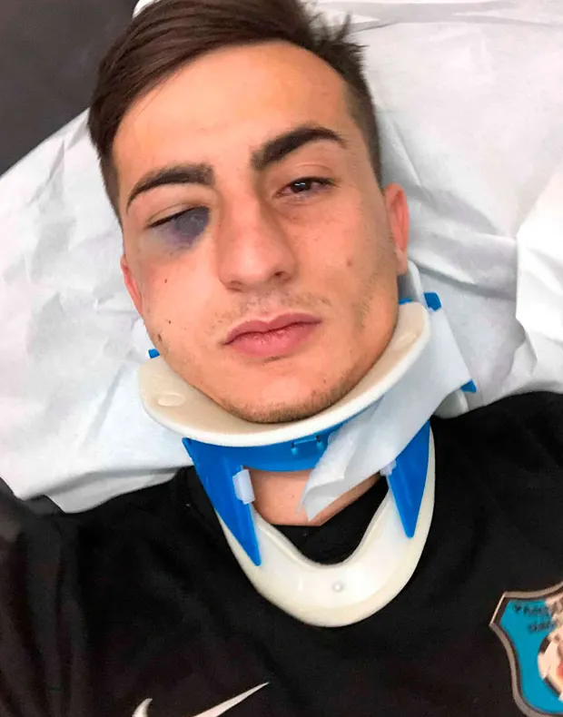 Căpitanul Pandurilor are nevoie de mai multe operații la față