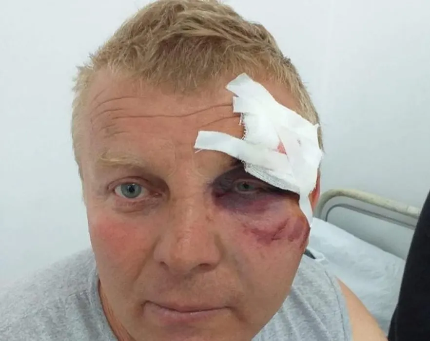 Angajat al CEO, bătut de hoții de fier. Unul dintre agresori e șoferul primarului din Fărcășești