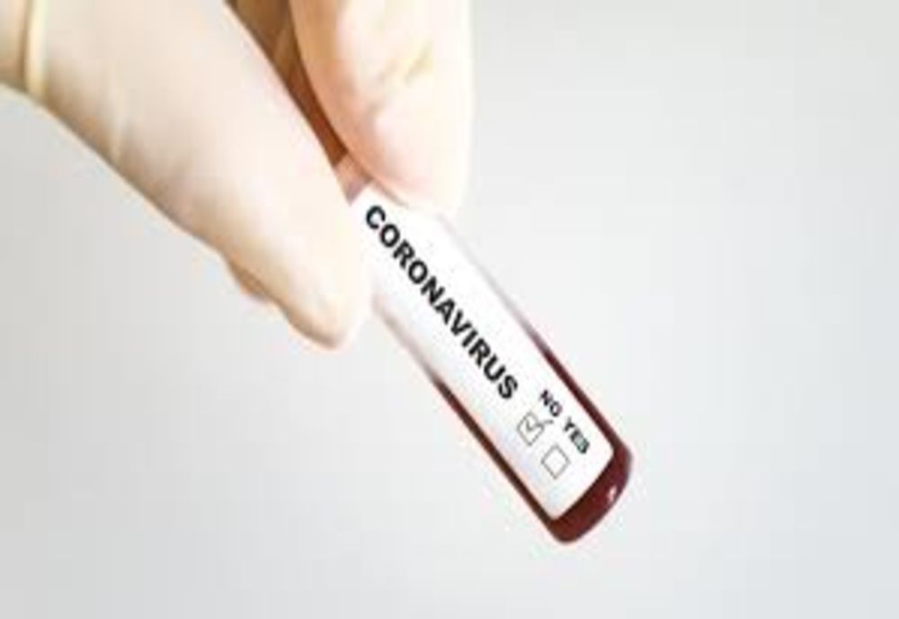 COVID-19: 823 de cazuri noi la 8.045 de teste. Cazurile noi, pe județe