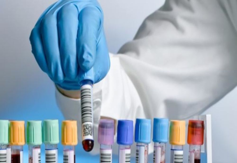 PALMED: PACIENȚII PLĂTESC ANALIZE MEDICALE PENTRU CĂ FONDURILE CNAS SE EPUIZEAZĂ ÎN PRIMELE ZILE ALE LUNII