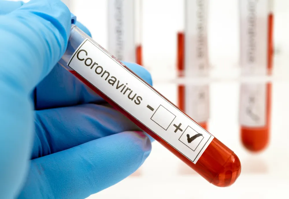 Niciun caz nou de coronavirus în Gorj