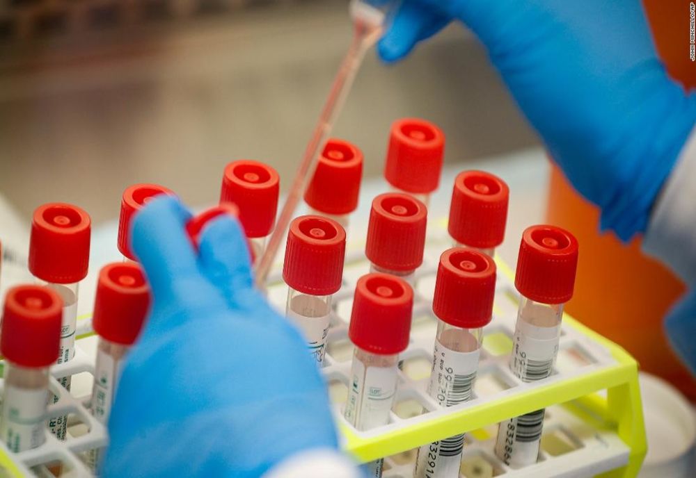 Coronavirus Gorj: 160 de cazuri confirmate!