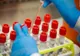 Coronavirus Gorj: 160 de cazuri confirmate!