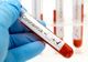 Niciun caz nou de coronavirus în Gorj