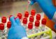 Coronavirus Gorj: 160 de cazuri confirmate!
