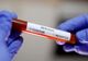 Bilanț coronavirus 12 martie: 5.010 cazuri noi și 108 decese