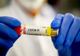 Coronavirus, cifre ÎN CREŞTERE: 4.342 cazuri noi şi 101 decese | RAPORT pe judeţe